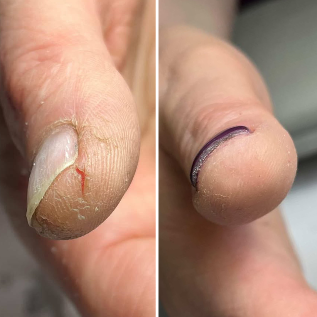 Resultum Regenerix Cream