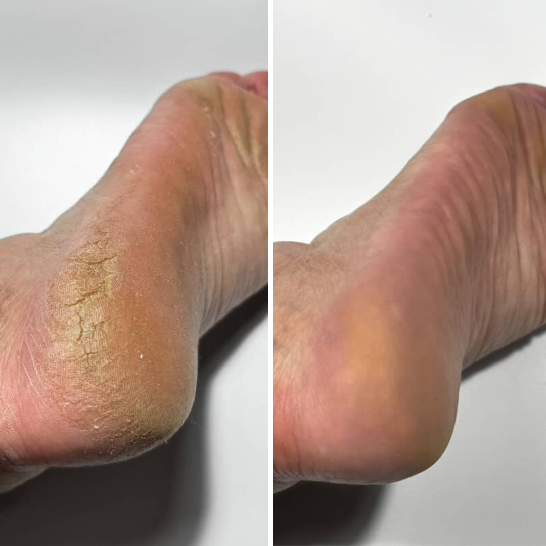 Resultum Regenerix Cream