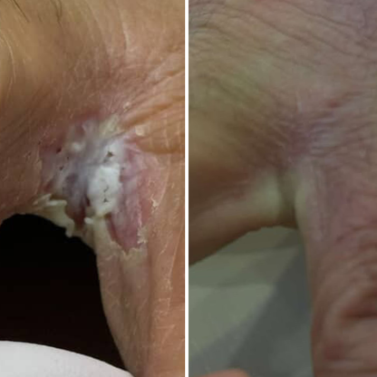 Resultum Soleverum Soap