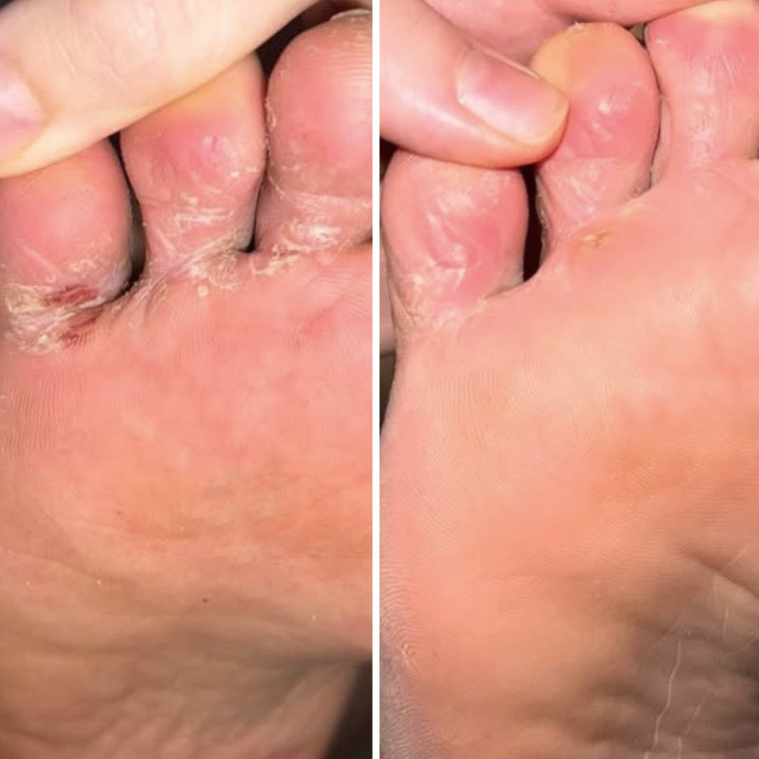 Resultum Soleverum Soap