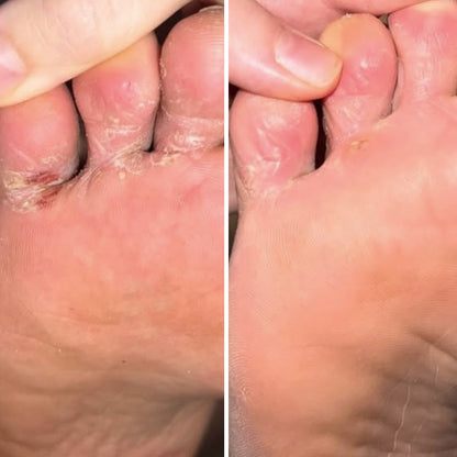 Resultum Soleverum Soap