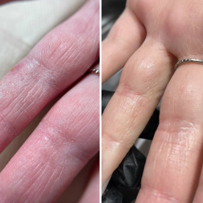 Resultum Soleverum Soap