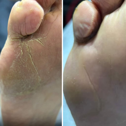 Resultum Soleverum Soap