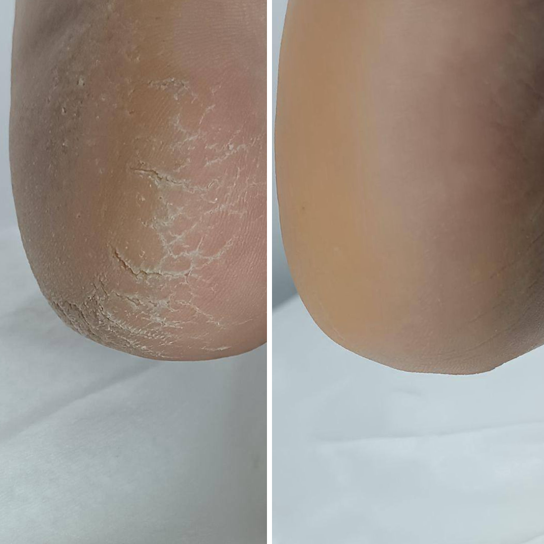 Resultum Regenerix Cream