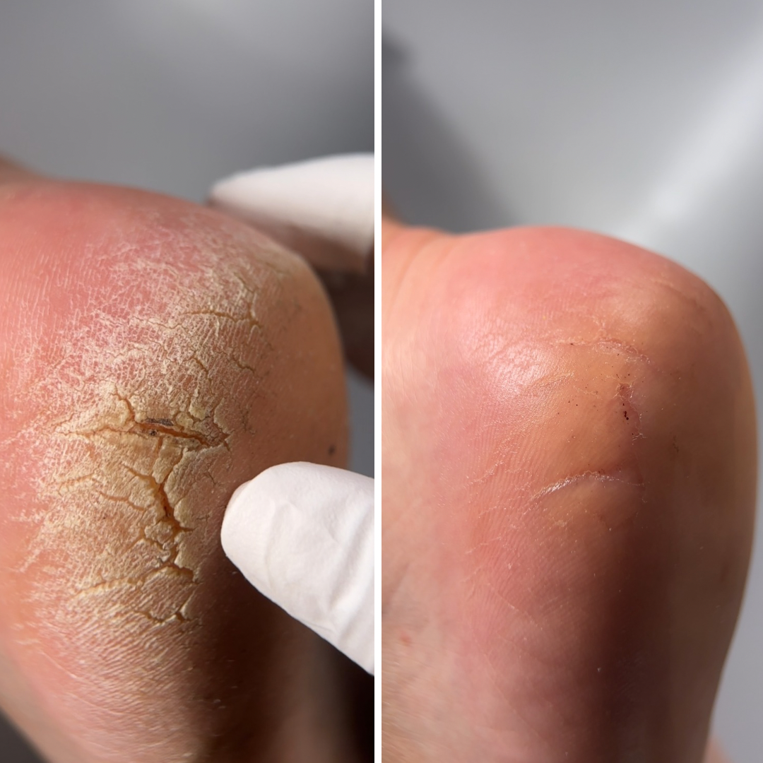 Resultum Regenerix Cream